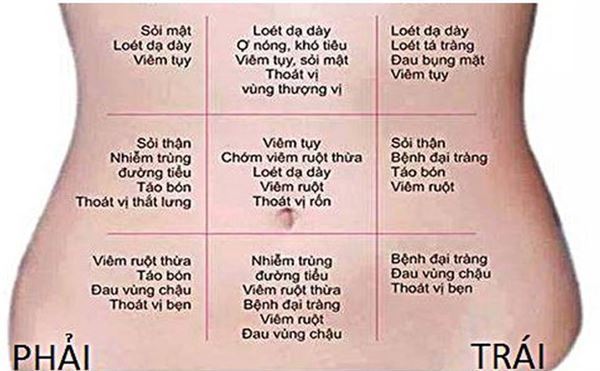 Đau bụng 4